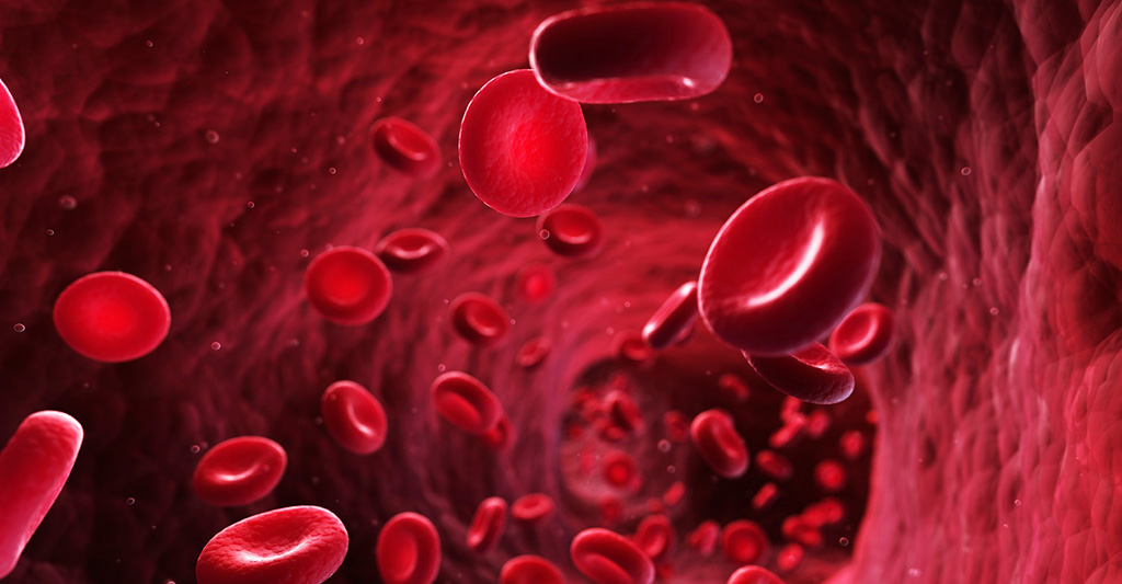 El flujo sanguíneo es esencial para la metástasis en el cáncer