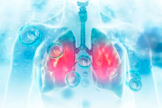 El ECDC explica cómo se produce la transmisión de la peste pulmonar