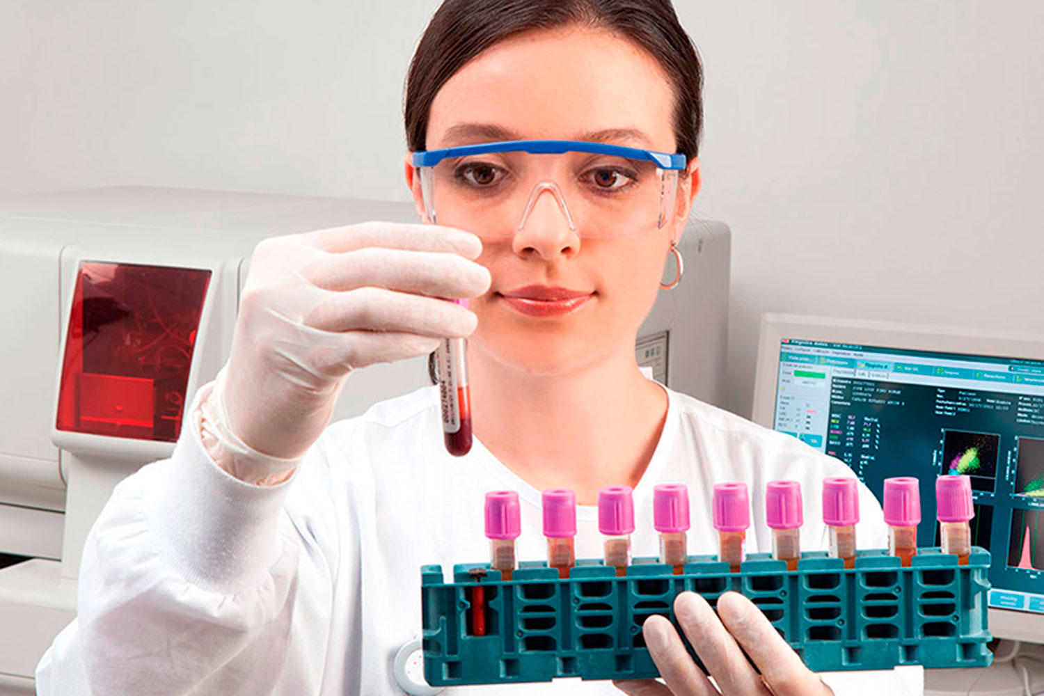 PROTEINA C REACTIVA ULTRASENSIBLE PCR-US