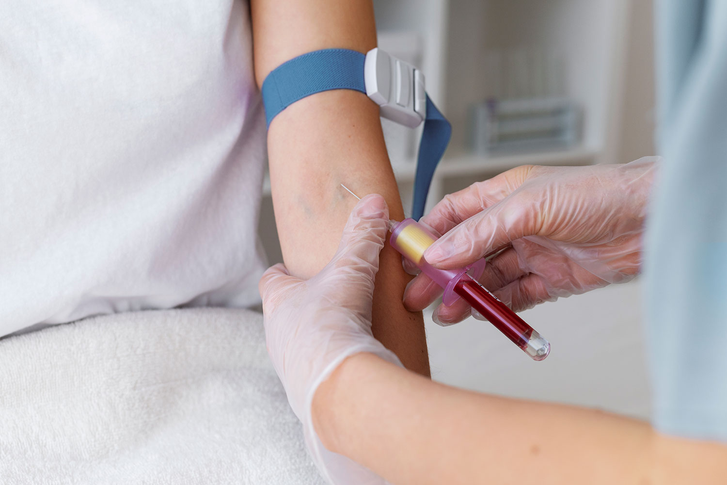 Un test de sangre detecta la esclerosis múltiple años antes de que se desarrolle