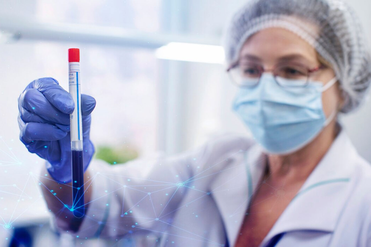  Nueva prueba disponible en el Laboratorio: Panel para diagnóstico molecular de ITS por PCR