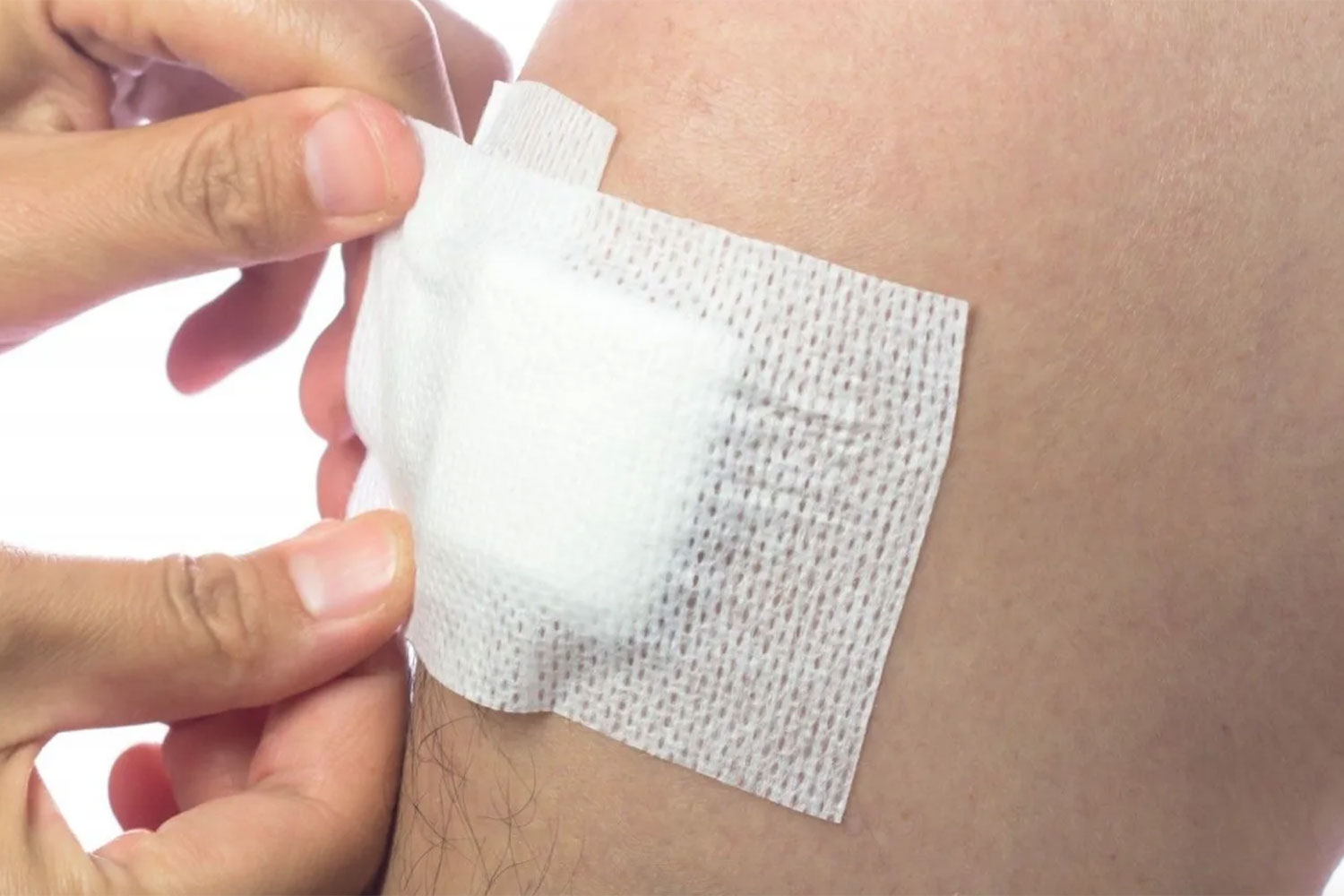 Diseñan un apósito inteligente que detecta infecciones a partir de la temperatura de la piel