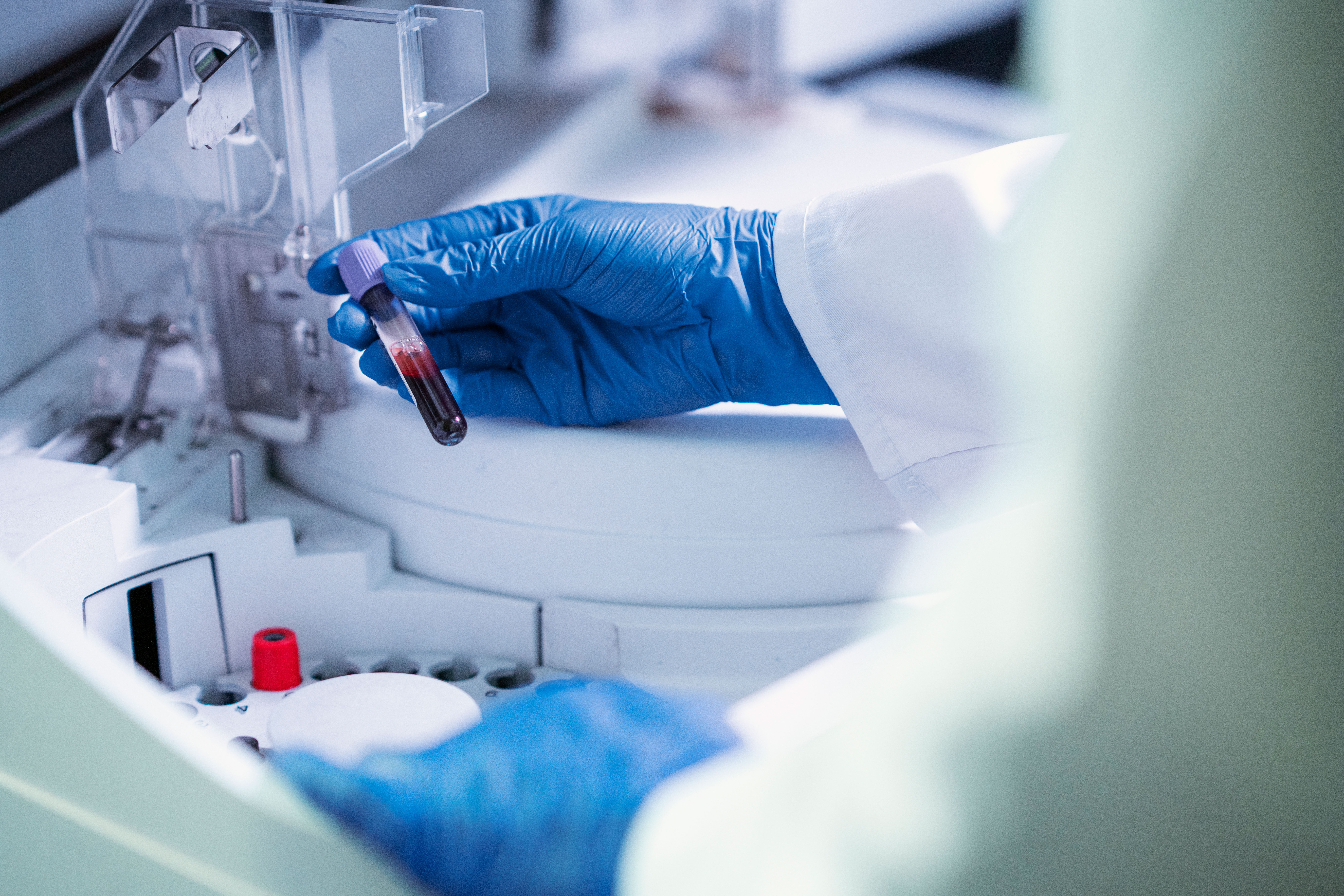 Nueva prueba disponible en el Laboratorio: LIPROPROTEÍNA A