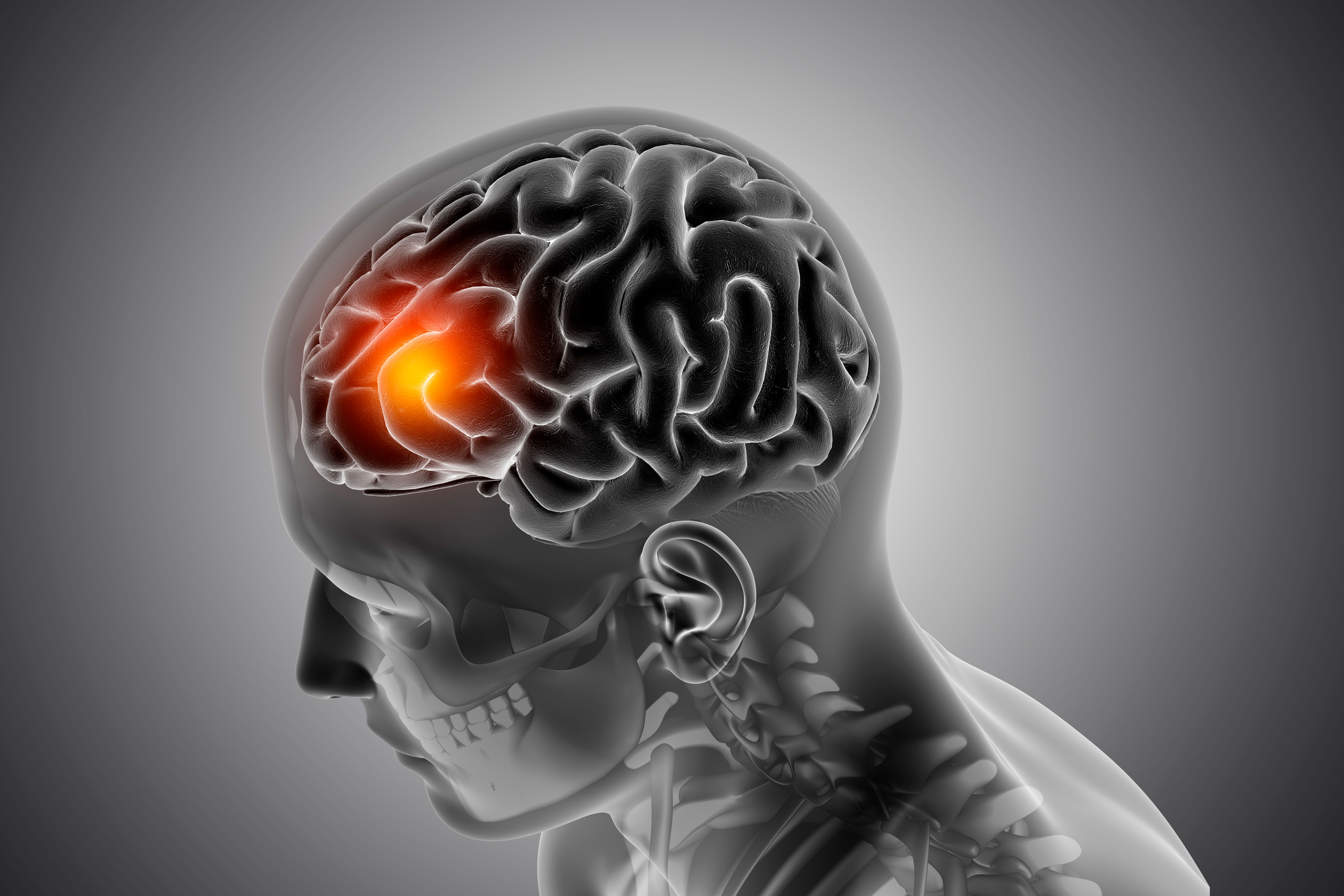 Logran una nueva técnica para tratar el tumor cerebral más letal con quimioterapia